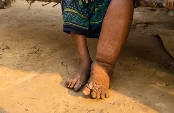 ފައިލާރިޔާ ޖެހިފައިވާ މީހެއް -- ފޮޓޯ: ޑަބްލިއުއެޗްއޯ